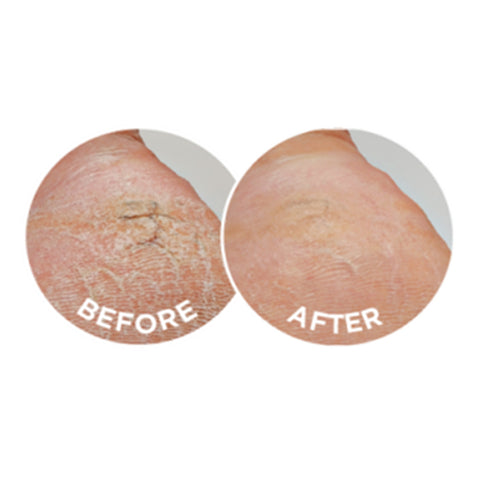 Dermal Therapy Heel Magic Dermal Therapy Heel Magic