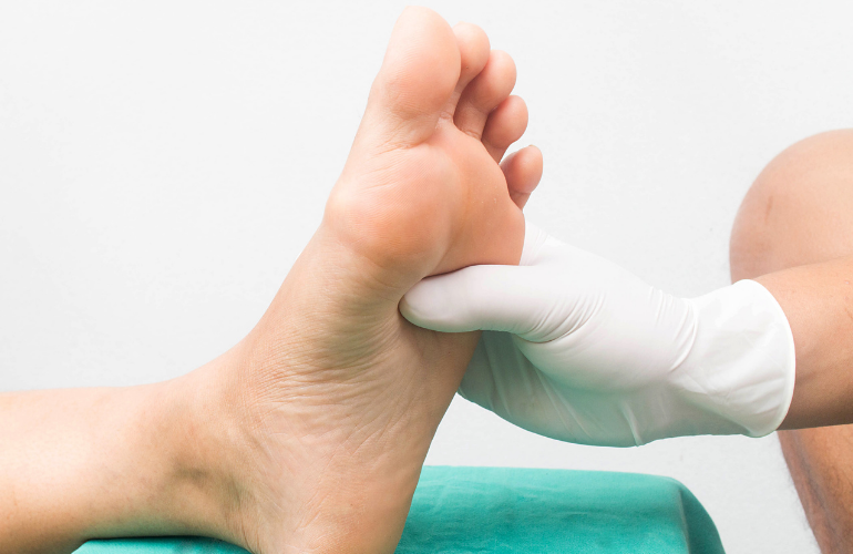 Peripheral Neuropathy: Everything You Need to Know