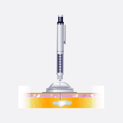 Medtronic i-port Advance Cannula 6mm 10pk