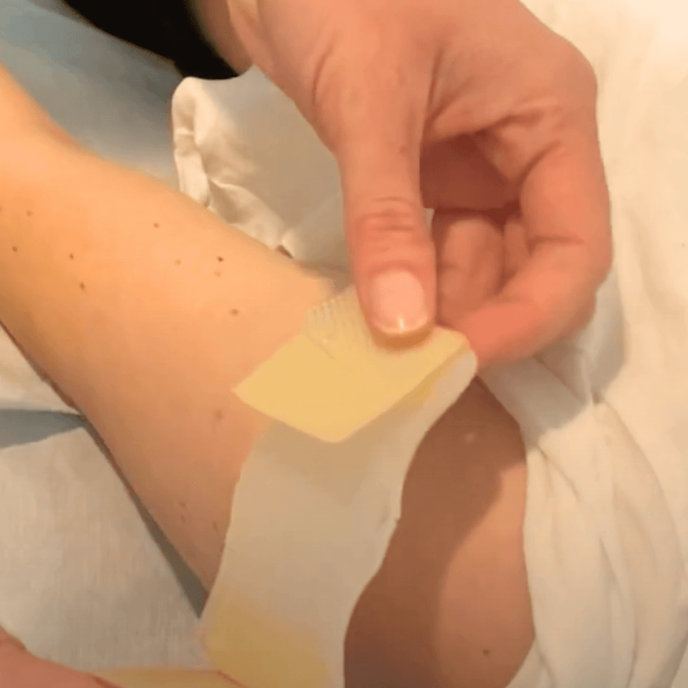 NeedleCalm Needle Desensitising Adhesive Pads 7pk