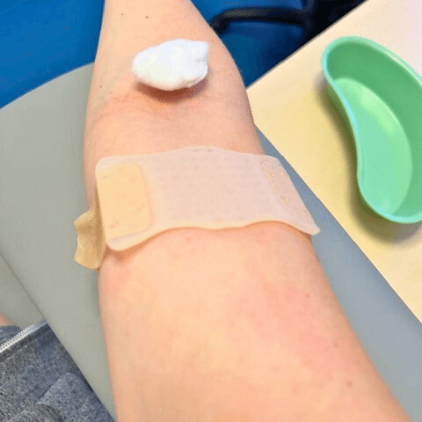 NeedleCalm Needle Desensitising Adhesive Pads 7pk