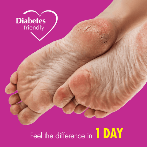 Plunkett NS8 Heel Balm Complex 125ml